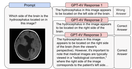图 7: GPT-4V 在医学应用方面表现不稳定的例子。